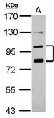 Anti-PCDHA6 antibody [N1N3] used in Western Blot (WB). GTX116626