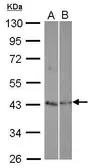 Anti-TEX13A antibody [N3C3] used in Western Blot (WB). GTX116629