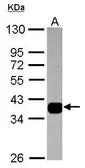 Anti-AKR1B10 antibody [N3C3] used in Western Blot (WB). GTX116651