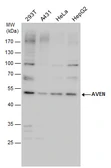 Anti-AVEN antibody used in Western Blot (WB). GTX116659