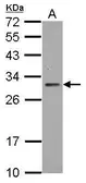 Anti-TIGAR antibody [N1C3] used in Western Blot (WB). GTX116660