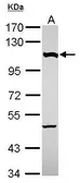 Anti-NUP107 antibody used in Western Blot (WB). GTX116664