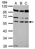 Anti-Coronin 1B antibody [N2C2], Internal used in Western Blot (WB). GTX116667