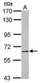 Anti-MTA3 antibody [N3C2], Internal used in Western Blot (WB). GTX116676