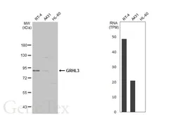 Anti-GRHL3 antibody used in Western Blot (WB). GTX116700