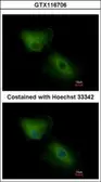 Anti-CXCL16 antibody used in Immunocytochemistry/ Immunofluorescence (ICC/IF). GTX116706