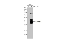 Anti-CXCL16 antibody used in Western Blot (WB). GTX116706