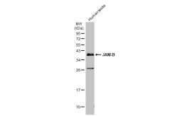 Anti-JAM-B antibody [N2C3] used in Western Blot (WB). GTX116710
