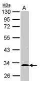 Anti-ALS2CR1 antibody [N3C3] used in Western Blot (WB). GTX116727