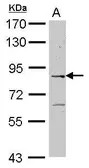 Anti-ELMO2 antibody [C1C3] used in Western Blot (WB). GTX116730