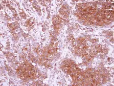 Anti-CIDEC antibody used in IHC (Paraffin sections) (IHC-P). GTX116733