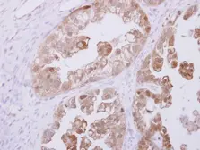 Anti-RBKS antibody [N1C1] used in IHC (Paraffin sections) (IHC-P). GTX116738