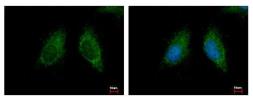 Anti-MCCC2 antibody used in Immunocytochemistry/ Immunofluorescence (ICC/IF). GTX116739