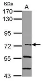 Anti-IKB zeta antibody [N3C3] used in Western Blot (WB). GTX116752
