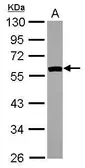 Anti-SIL1 antibody [N1N3] used in Western Blot (WB). GTX116755