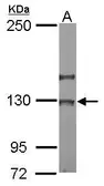 Anti-NOL6 antibody [C2C3], C-term used in Western Blot (WB). GTX116786