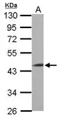 Anti-LRRC2 antibody [N2C3] used in Western Blot (WB). GTX116821