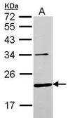 Anti-CHMP6 antibody [N1C3] used in Western Blot (WB). GTX116824