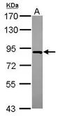 Anti-FLJ21908 antibody used in Western Blot (WB). GTX116827
