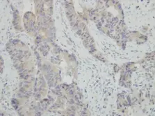 Anti-HSPBAP1 antibody [N2C1], Internal used in IHC (Paraffin sections) (IHC-P). GTX116828