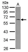 Anti-HSPBAP1 antibody [N3C3] used in Western Blot (WB). GTX116829