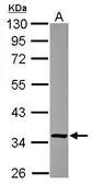 Anti-FN3KRP antibody [N2C3] used in Western Blot (WB). GTX116830