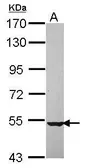 Anti-NPEPL1 antibody [N3C3] used in Western Blot (WB). GTX116835
