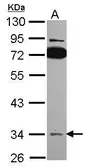 Anti-SLC25A22 antibody [N1C3-2] used in Western Blot (WB). GTX116838