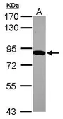 Anti-HPS6 antibody [N2C1], Internal used in Western Blot (WB). GTX116845