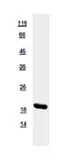 Human Gemin 6 protein, His tag. GTX116846-pro