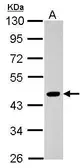 Anti-Pygopus 2 antibody used in Western Blot (WB). GTX116847