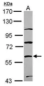 Anti-ZNF671 antibody [N1C1] used in Western Blot (WB). GTX116856