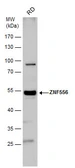 Anti-ZNF556 antibody used in Western Blot (WB). GTX116867