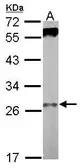 Anti-WDR61 antibody used in Western Blot (WB). GTX116881