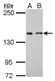 Anti-COLEC12 antibody [N2C1], Internal used in Western Blot (WB). GTX116892