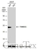 Anti-TXNDC5 antibody used in Western Blot (WB). GTX116898