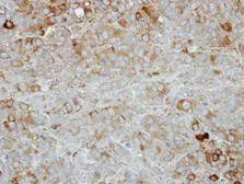 Anti-PVRL4 antibody [N1C1] used in IHC (Paraffin sections) (IHC-P). GTX116900