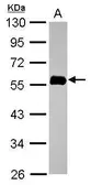 Anti-NORE1 antibody used in Western Blot (WB). GTX116921