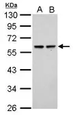 Anti-SESN2 antibody used in Western Blot (WB). GTX116925