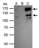 Anti-SETDB2 antibody [N1N2], N-term used in Immunoprecipitation (IP). GTX116932