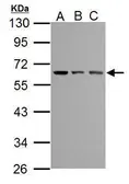 Anti-TEM8 antibody used in Western Blot (WB). GTX116952
