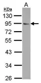 Anti-FLYWCH1 antibody used in Western Blot (WB). GTX116956