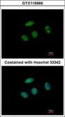 Anti-PHF6 antibody [N2C2], Internal used in Immunocytochemistry/ Immunofluorescence (ICC/IF). GTX116966