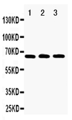 Anti-RANK antibody used in Western Blot (WB). GTX11697