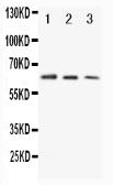 Anti-CD86 antibody used in Western Blot (WB). GTX11698