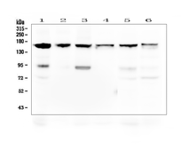 Anti-Thrombospondin 2 antibody used in Western Blot (WB). GTX11699