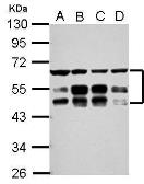 Anti-ZFYVE19 antibody used in Western Blot (WB). GTX117000