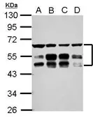 Anti-ZFYVE19 antibody used in Western Blot (WB). GTX117000