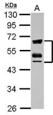 Anti-ZFYVE19 antibody used in Western Blot (WB). GTX117001
