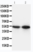 Anti-CD14 antibody used in Western Blot (WB). GTX11702